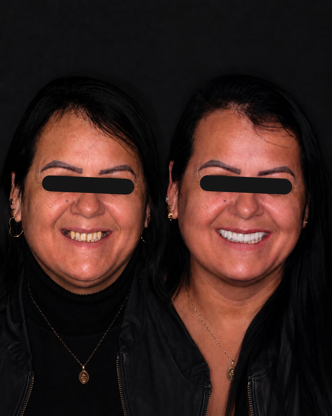Resultado real de paciente Studio Alis — antes e depois do tratamento